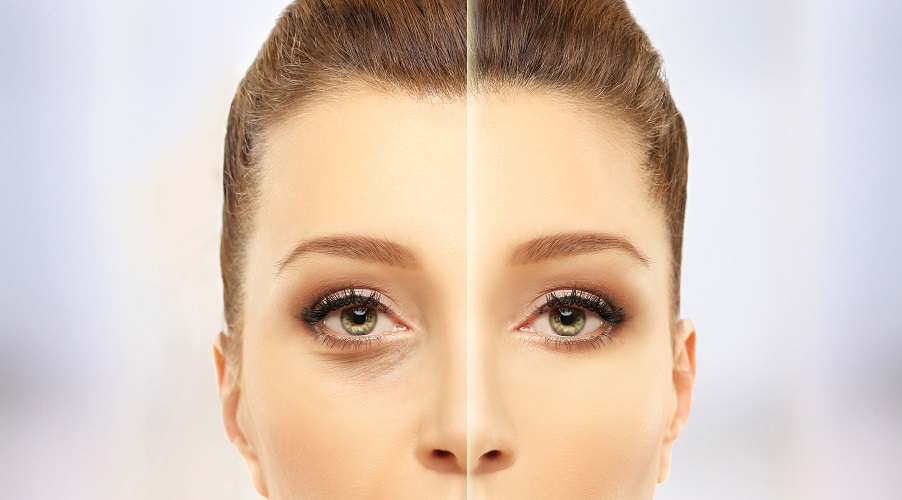 Under Eye Light Filling