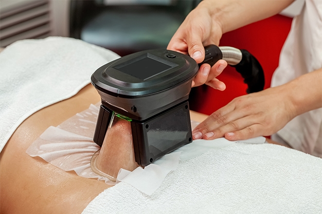 Lipolysis