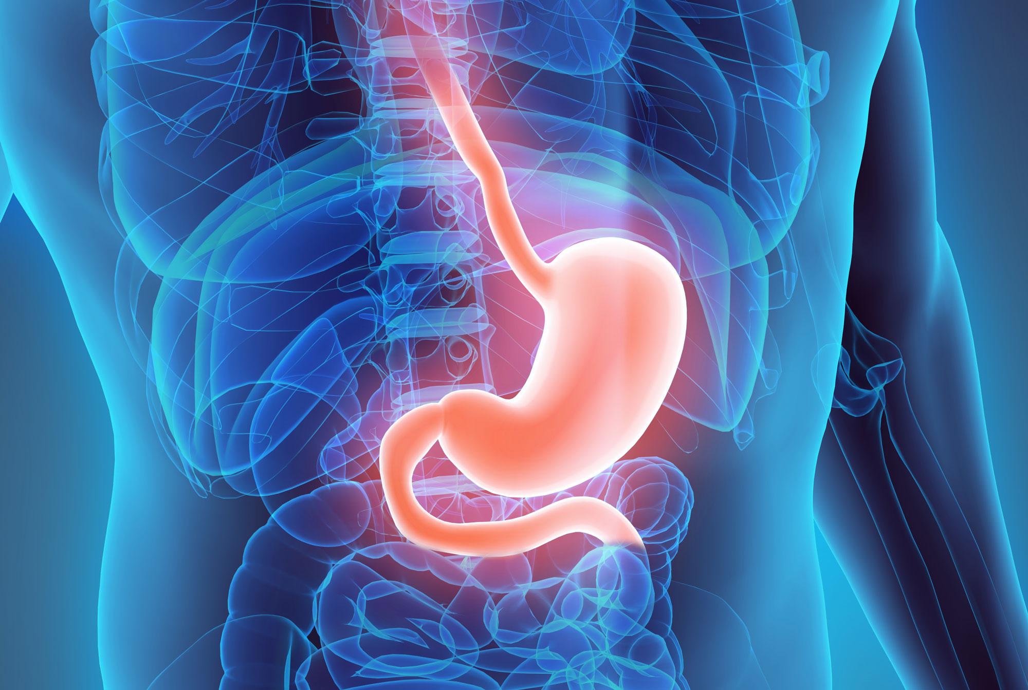 Gastric Bypass