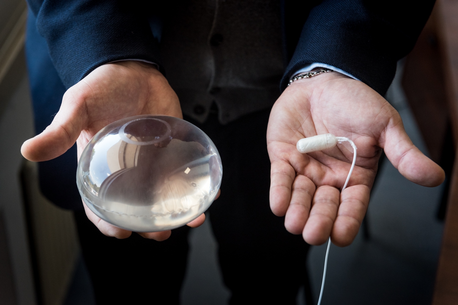 Gastric Balloon